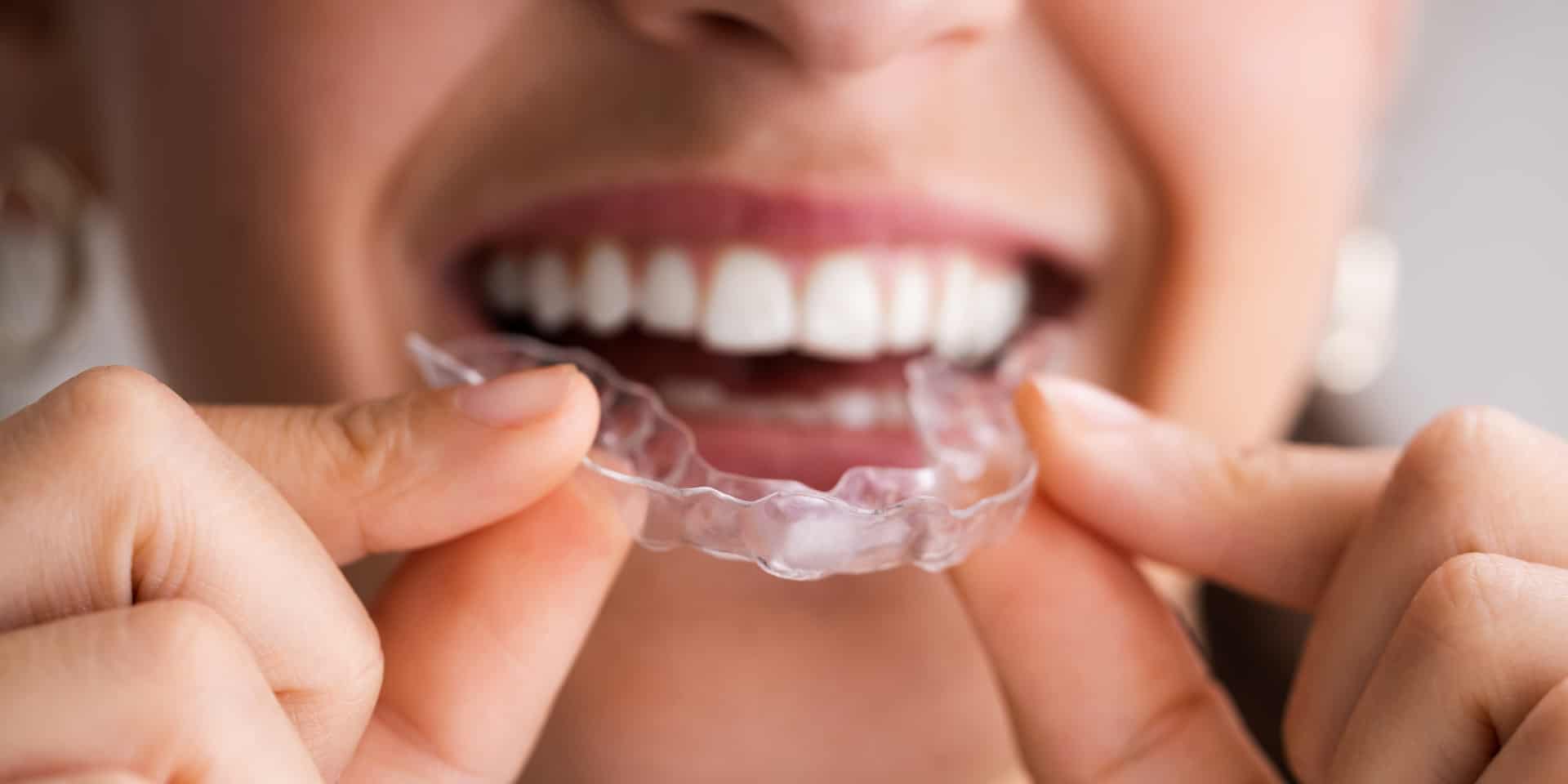 Invisalign San Ramon Invisalign San Ramon