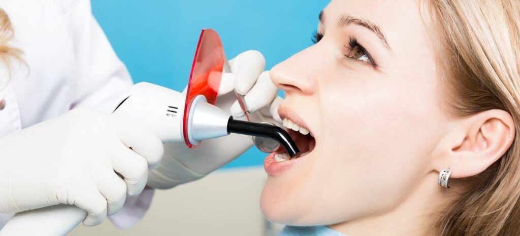 Composite Bonding, Teeth Bonding Danville Ca