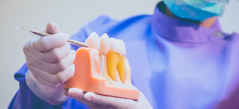 Dental Implants San Ramon Dental Implants San Ramon
