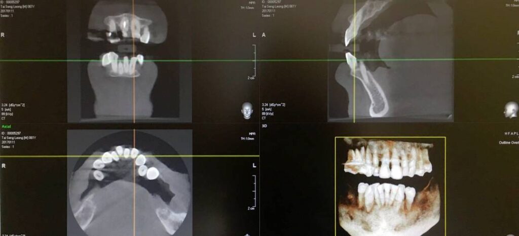 Digital Dental Imaging