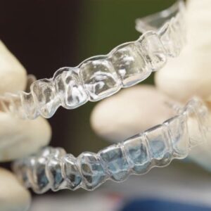 Invisalign Aligners