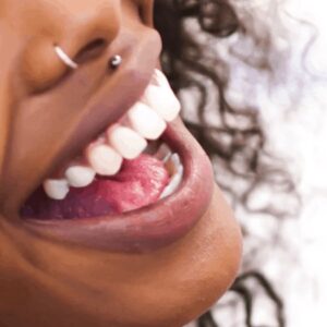 Porcelain Veneer Dentist