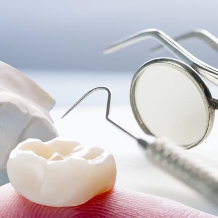 Tooth Crown Dentist Tooth Crown Dentist