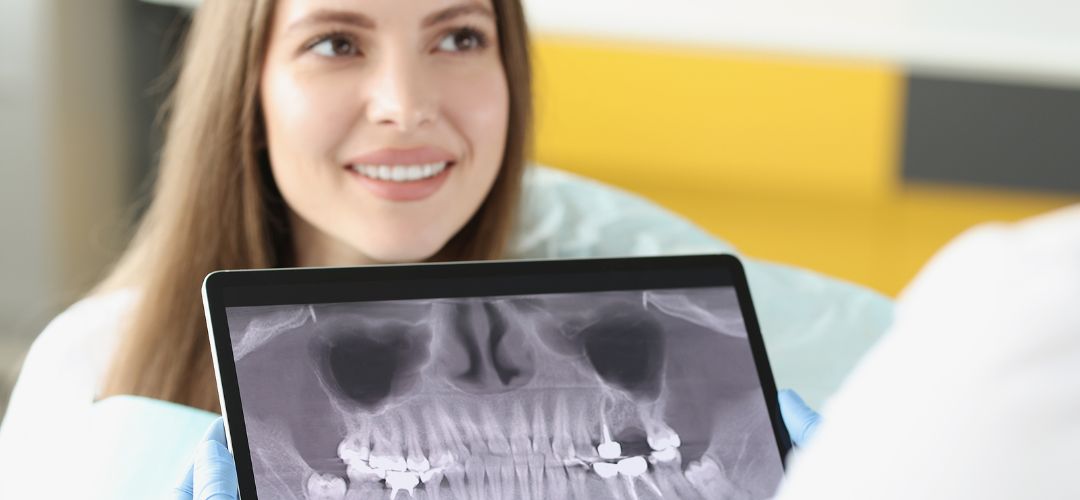 Dental XRays San Ramon, CA Pro Smile Dental Care