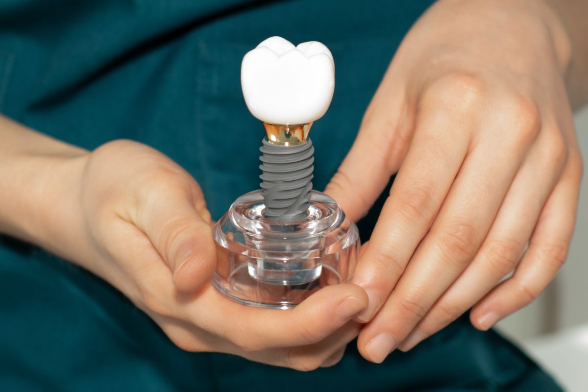Dentist holding a dental implant model showing the titanium post and crown structure for dental implants in san ramon