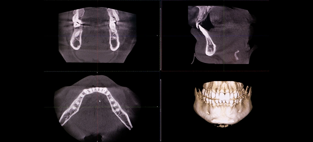img 3D X Rays CBCT