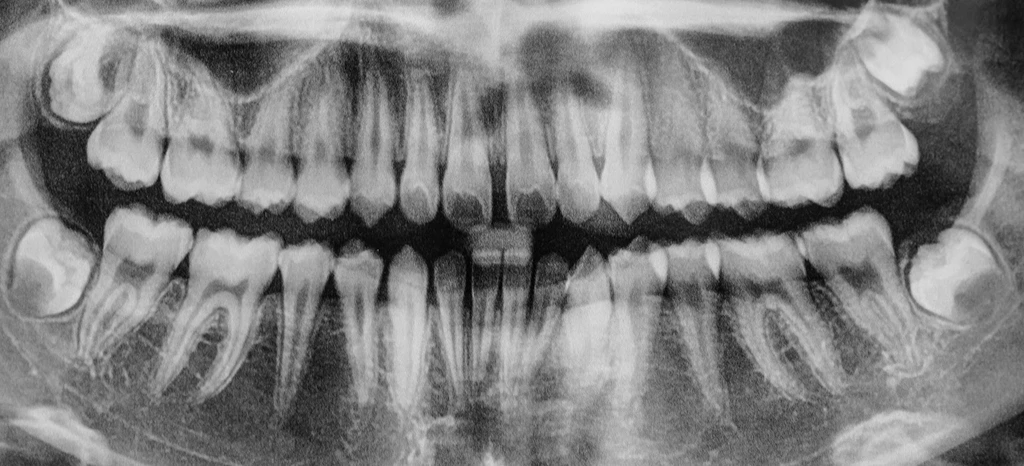 img Digital X Rays