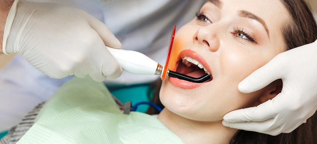 img natural colored fillings