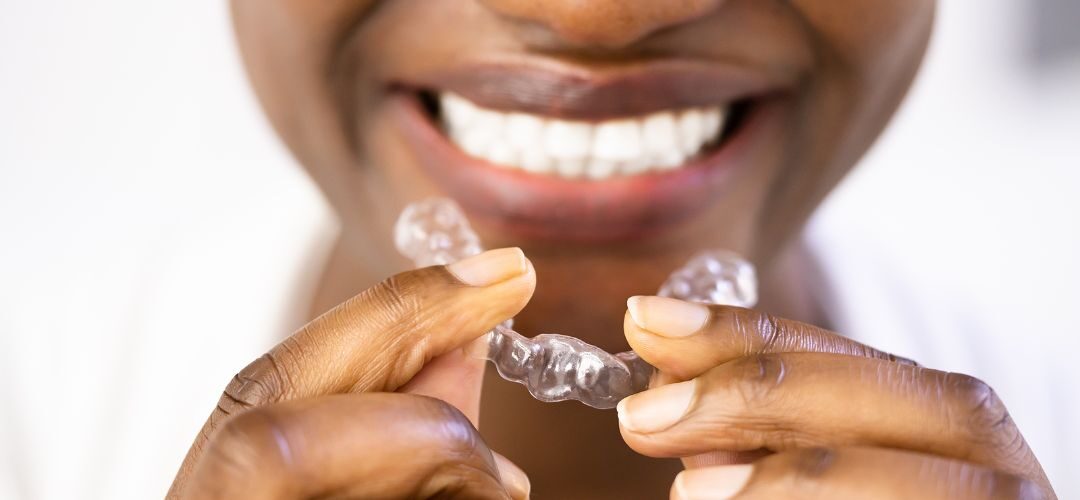 shifting-teeth-treatment