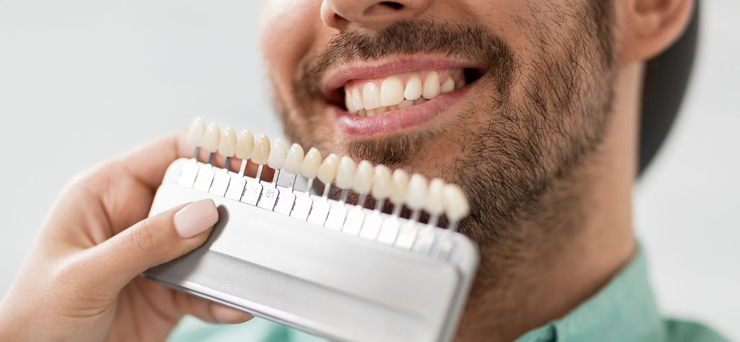 A dentist holding up dental veneers to someone's smile, to help them decide if veneers are right for them.