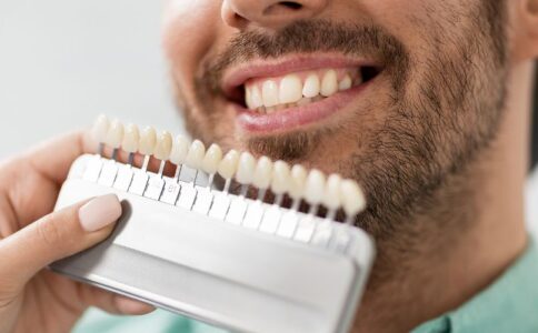 A dentist holding up dental veneers to someone's smile, to help them decide if veneers are right for them.