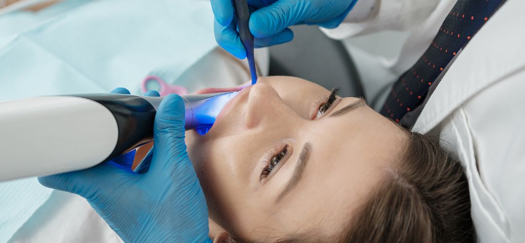 Digital Dental Impressions Danville, CA Pro Smile Dental Care